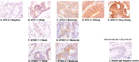 Figure 1 From Characterisation Of The Expression Of Neurotensin And Its