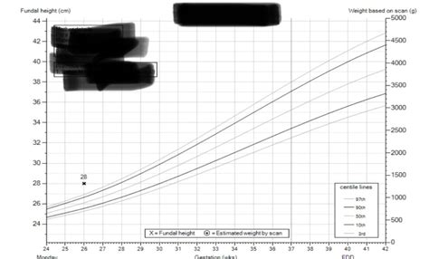 Fundal Height Chart Mumsnet