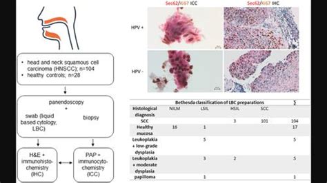 Dual Sec Ki Immunocytochemistry Of Liquid Based Cytological