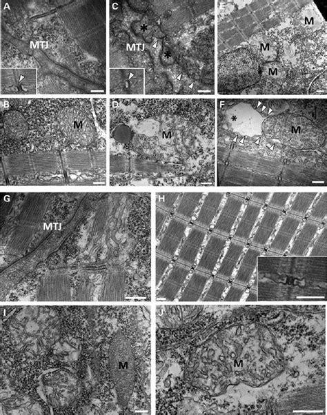 Ultrastructural analysis of 48 hpf zebrafish embryos. Control ( A and B ... 