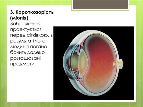 Захворювання очей - презентация онлайн