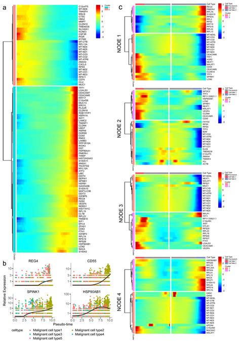 Single Cell Transcriptome Reveals The Heterogeneity Of Malignant Ductal