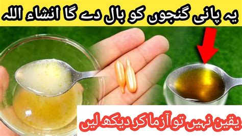 Hair Growth Home Remedies Fast Hair Growth Oil At Home Youtube