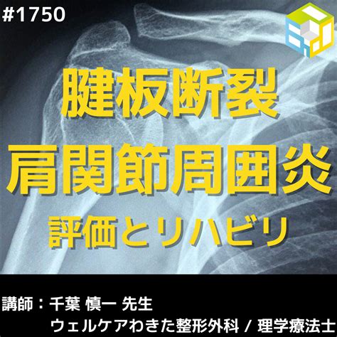 肩関節のリハビリテーション｜肩関節周囲炎・腱板断裂に対するアプローチを学ぶ エポックセミナー