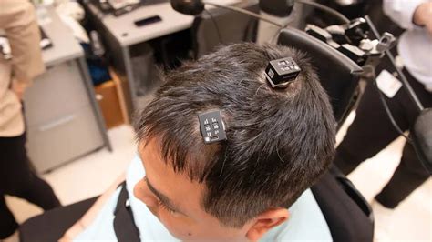 Implantes cerebrales basados en IA ayudan a un hombre paralítico a