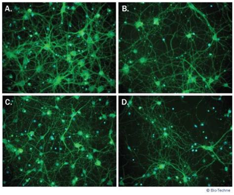 Neuroxvivo Rat Cortical Neuron Culture Kit Cdk011 Bio Techne