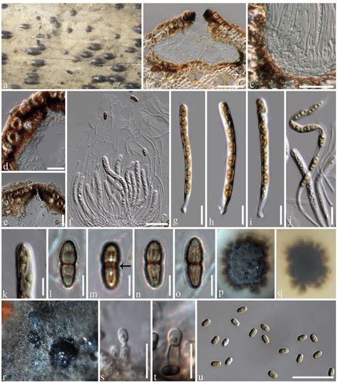 Neoroussoella Alishanense Mflu Holotype A Appearance Of