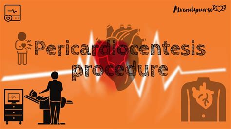 What Is Pericardiocentesis How It Is Done Pericardiocentesis