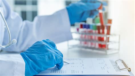 cr group  sold  shares   biosystems ttoo stock