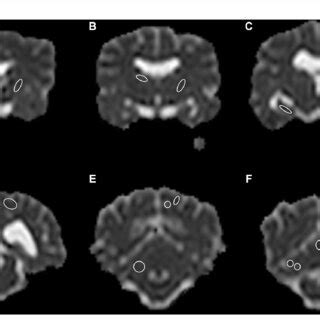 total   anatomical regions  defined  regions  interest  scientific