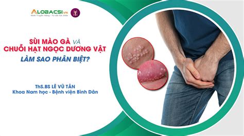 Sùi mào gà và chuỗi hạt ngọc dương vật Làm sao để phân biệt Hỏi