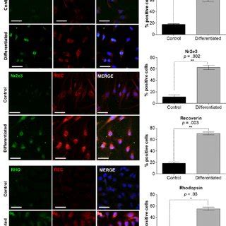 In vitro differentiation of human Müller glia with stem cell