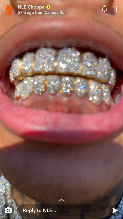 nle choppa grill | Diamond grillz, Grills teeth, Grillz teeth