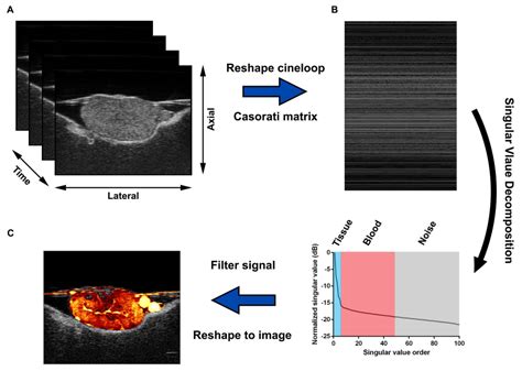 Contrast Free Ultrafast Microvessel Imaging Songlab Uiuc