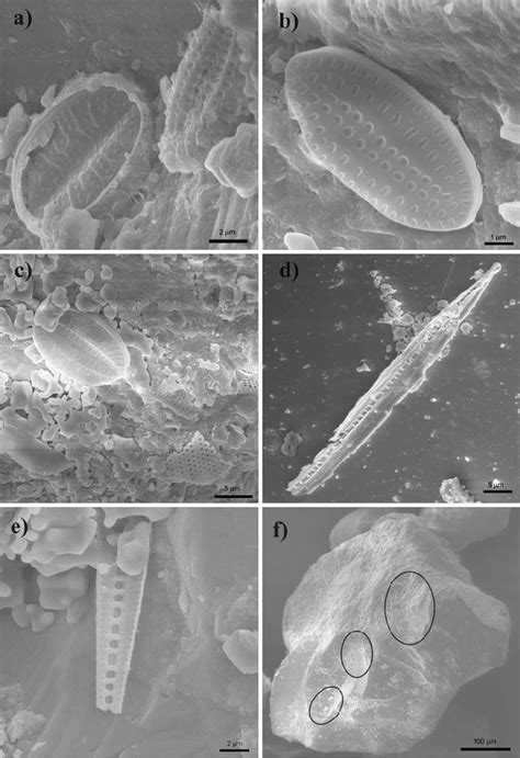 Benthic Diatoms Found Attached To Sand Grains A Diploneis Spp Left