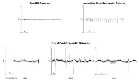 A Novel Model Of Post Traumatic Epilepsy And The Characterization Of