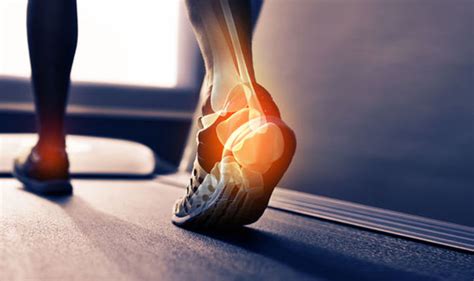 Chiropractic Care For Plantar Fasciitis Neuroathlete And Chiropractic Clinic