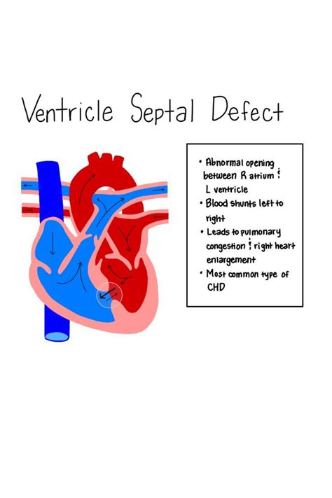 Pin on congenital heart defect