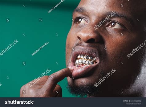 Slugs Gold Teeth