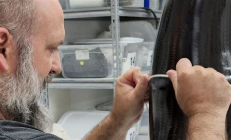 How Grace Takes The Lead In Custom Orthotics And Prosthetics