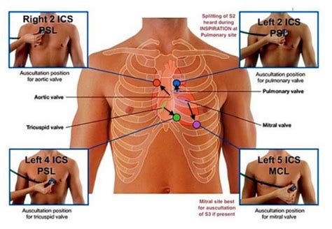 Cardiovascular Examination Flashcards Quizlet