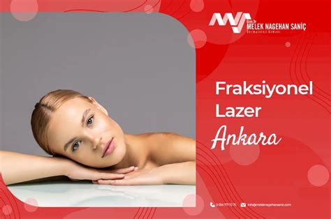 Fraksiyonel Lazer Ankara Fraksiyonel Lazer Fiyatları Ankara