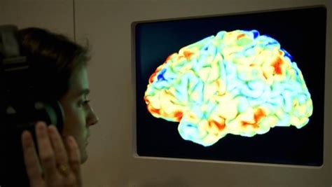 Un implant dans le cerveau pour restaurer la mémoire