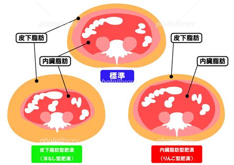 内臓脂肪と皮下脂肪の断面図名・説明あり イラスト素材 2342333 フォトライブラリー Photolibrary