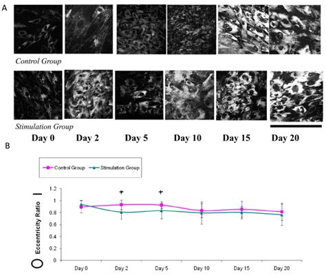 Morphological Changes During Osteogenic Stem Cell Differentiation A