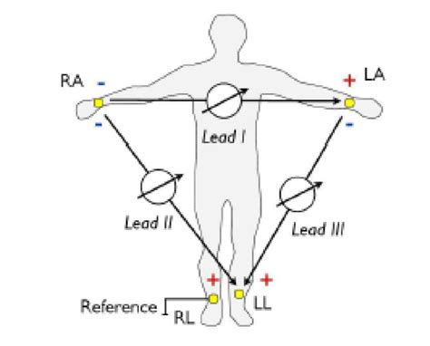 [DIAGRAM] 12 Lead Ekg Limb Diagram - MYDIAGRAM.ONLINE