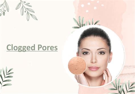 Clogged Pores – Myhi9