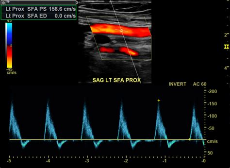 Sonography Vascular Peripheral Arterial Assessment Protocols And