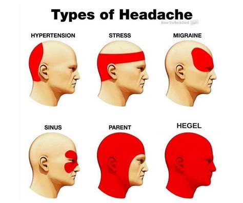 What kind of headache is it? A Hegel headache : r/PhilosophyMemes