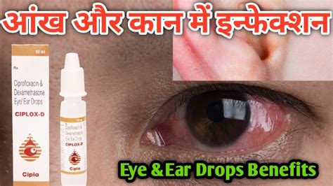 Ciplox D Eye Ear Drops Uses Benefits Side Effects In Hindi YouTube