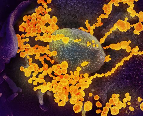 Novel Coronavirus SARS-CoV-2 | This scanning electron micros… | Flickr