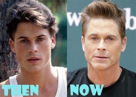 Rob Lowe Plastic Surgery Chin Implant And Other Procedures