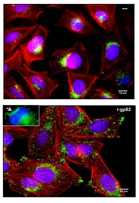 Lysosome Mobilization Induced By MT Gp82 Shown Are HeLa Cells