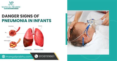 Danger Signs of Pneumonia in Infants?