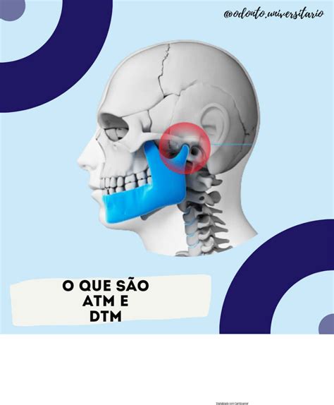 O Que S O Atm E Dtm Por Odonto Universitario Anatomofisiologia