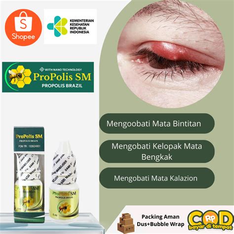 Jual Obat Oles Bengkak Gatal Pengempis Mata Bintitan Mata Kalazion