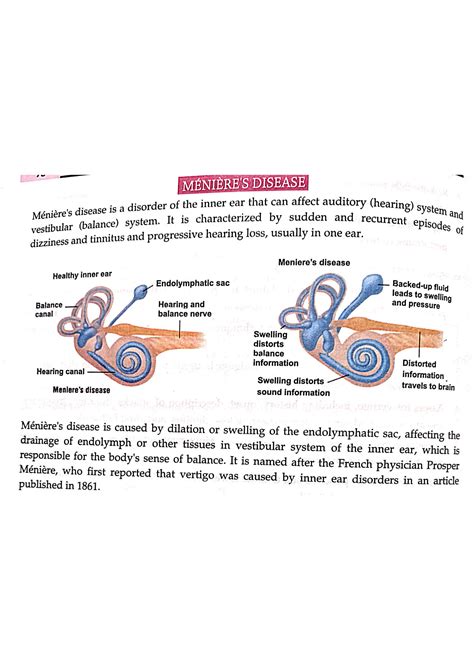 Solution Meniere S Disease Studypool