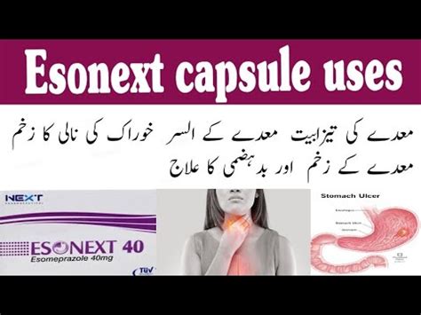 Esonext Mg Capsule Uses Benefit Side Effects In Urdu Esomeprazole