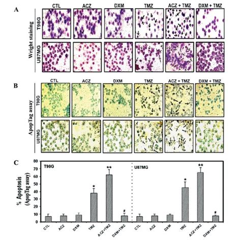 Determination Of Apoptosis In Glioblastoma Cells A Wright Staining