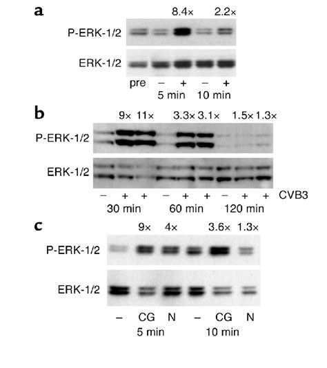 Cvb3 Infection Activates The Erk 12 Pathway In Jurkat Cells A