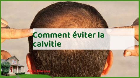 Chauve Qui Peut Strat Gies Pour Viter La Calvitie Et Conserver Une