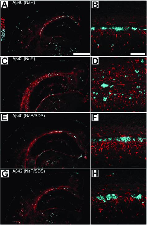 Fig S Reactive Astrogliosis Associated With The Induced Deposition