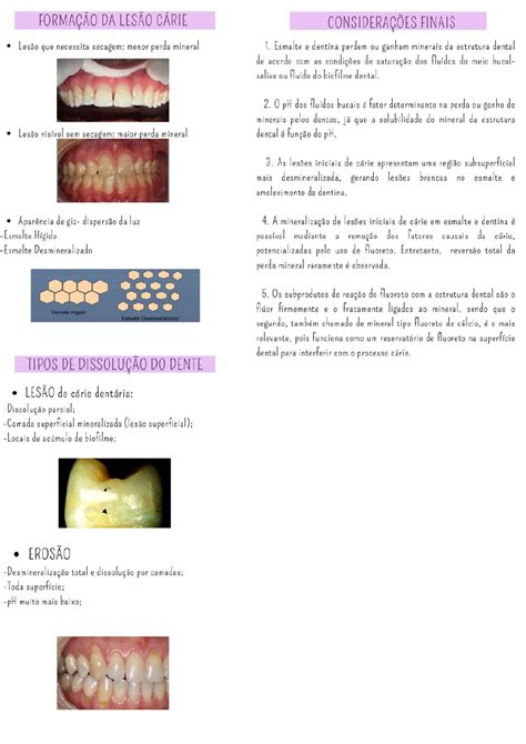 Interações químicas entre os dentes e fluídos bucais Clínica