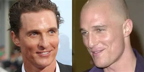 How Did Matthew Mcconaughey Solve Baldness And Regrow Hair Hair System