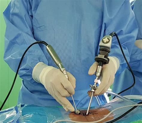 Clinical Results Of Percutaneous Biportal Endoscopic Lumbar Interbody