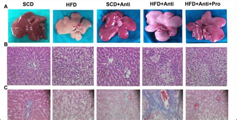 Histology of controls and NAFLD models including: (A) Representative... | Download Scientific ...